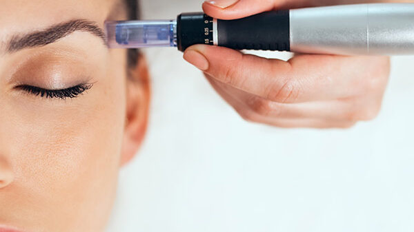 Formation BB Glow & Microneedling